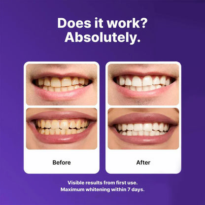Purple Teeth Whitening Strips | Fast, Gentle & Peroxide-Free Whitening