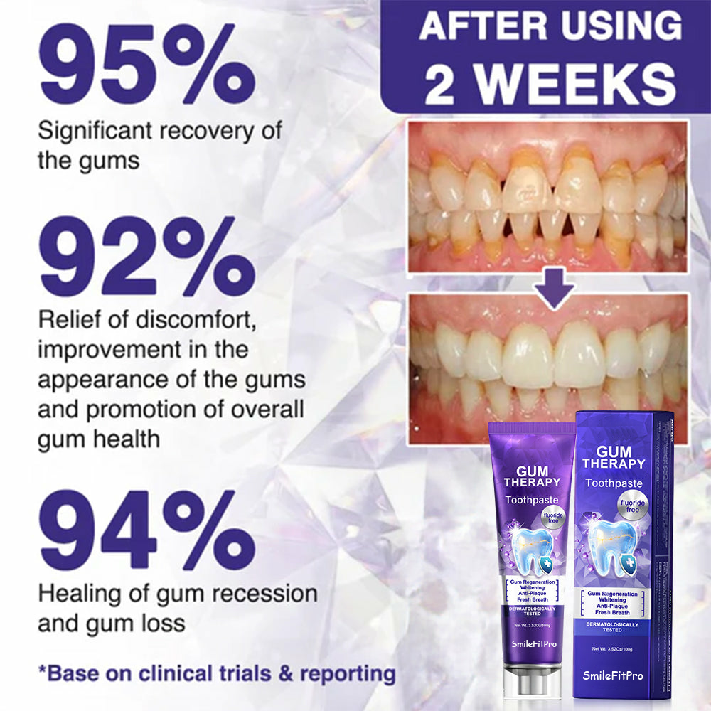 SmileFitPro  Dental Treatment Toothpaste Whiter Teeth Without Sensitivity