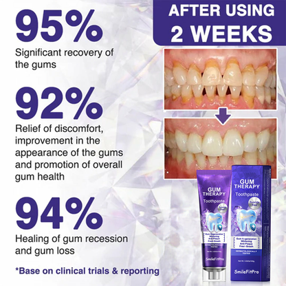 SmileFitPro  Dental Treatment Toothpaste Whiter Teeth Without Sensitivity