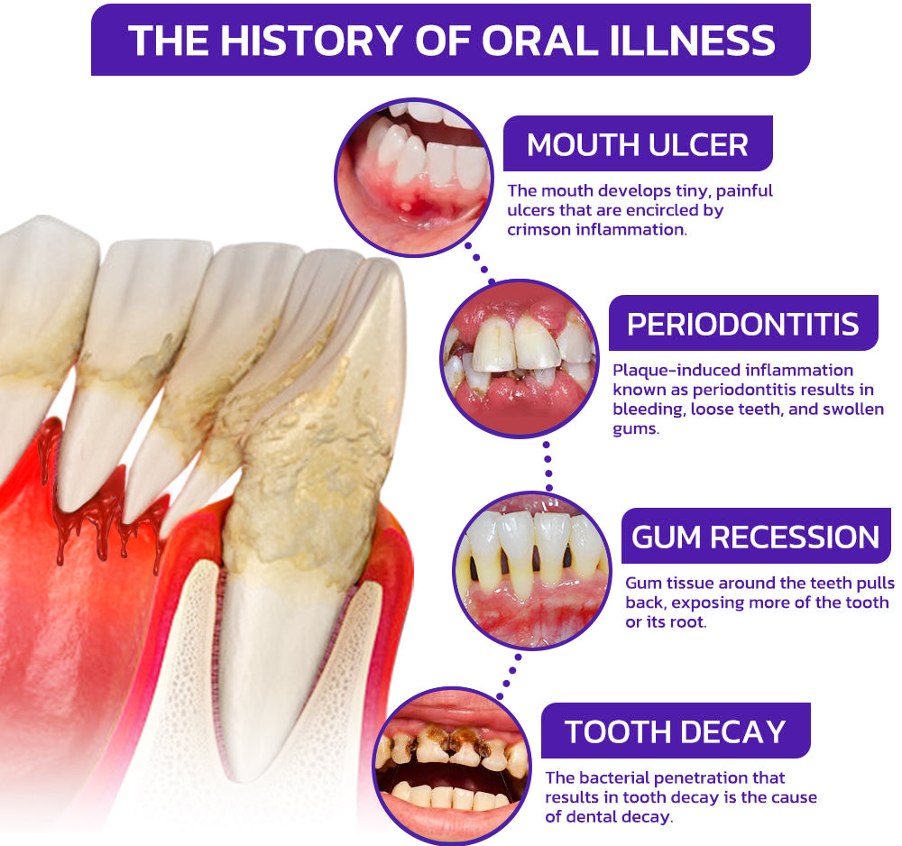 SmileFitPro  Dental Treatment Toothpaste Whiter Teeth Without Sensitivity