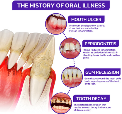 SmileFitPro  Dental Treatment Toothpaste Whiter Teeth Without Sensitivity